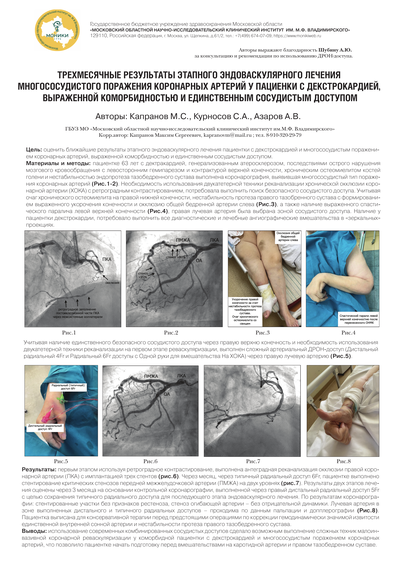 Трехмесячные результаты этапного эндоваскулярного лечения многососудистого поражения коронарных артерий у пациенки с декстрокардией, выраженной коморбидностью и единственным сосудистым доступом